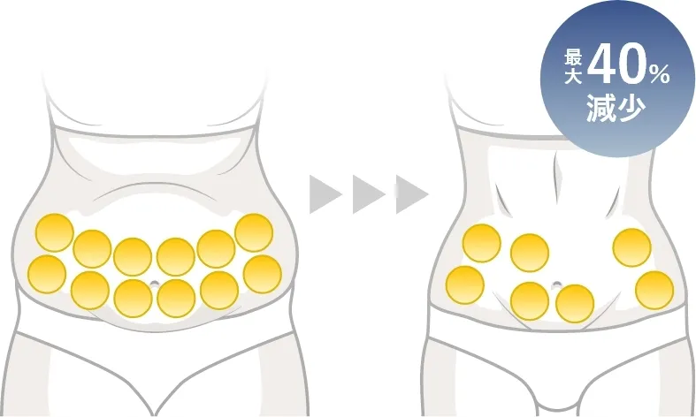 1回の治療で最大40%の脂肪減少率
